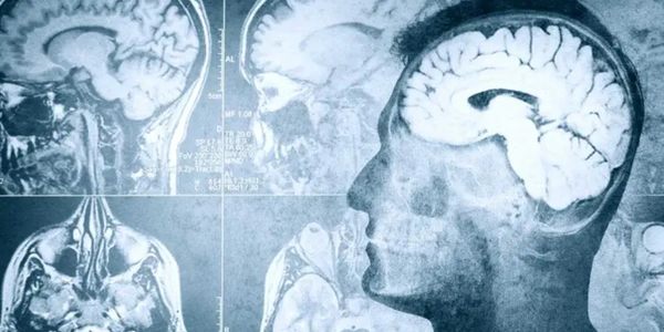 images Stili alimentari in ambito neurologico, 2 giorni di incontri a Catanzaro 