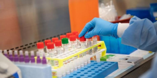 images Calabria zona gialla. I dati del monitoraggio: Rt a 0,81 e resta il rischio basso 